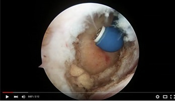 Surgical Video - Med X Change